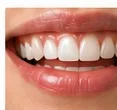 Clareamento dental